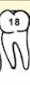 Tooth 18