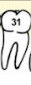 Tooth 31